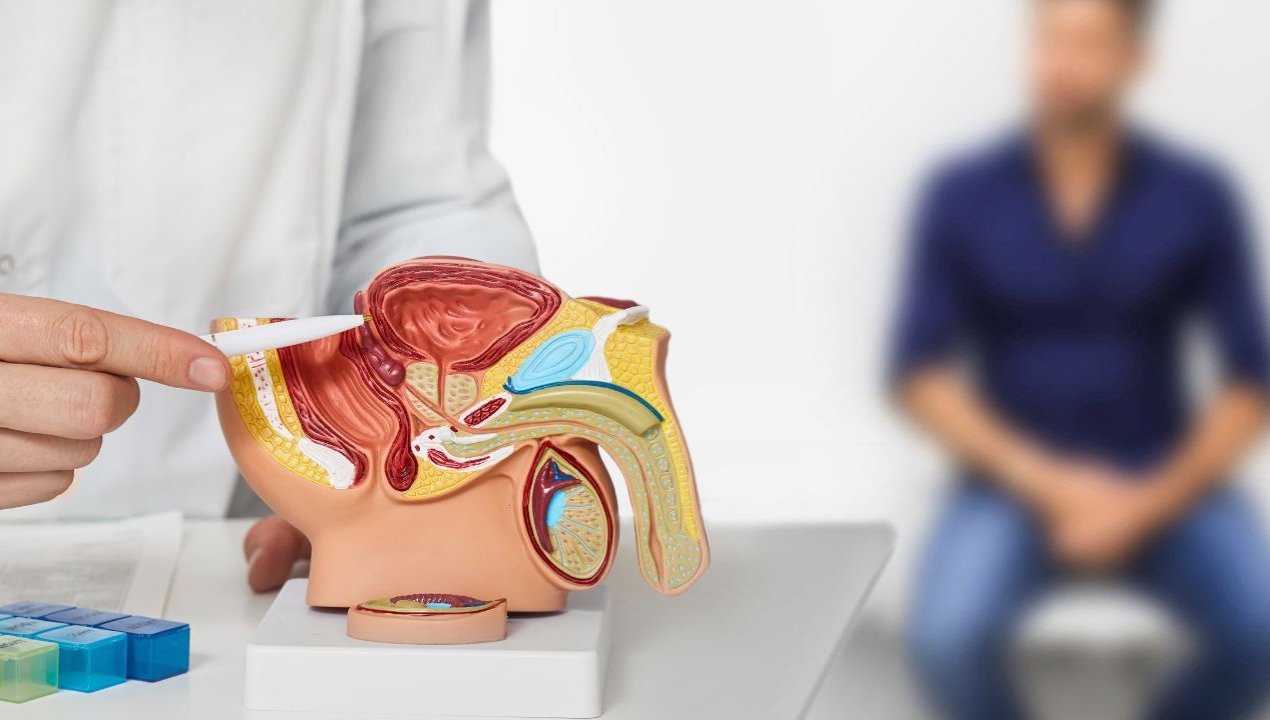 /cancer-de-prostata-especialista-llama-a-hombres-de-los-lagos-a-controlarse