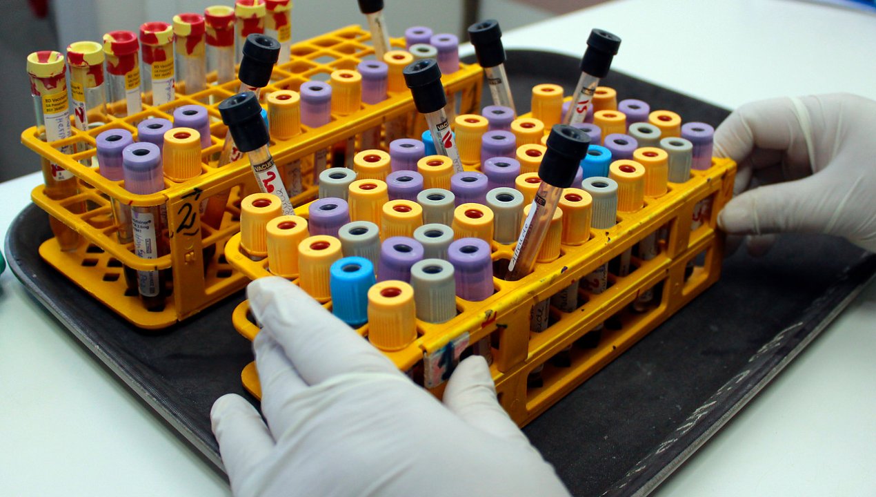 /dejo-raices-en-su-garganta-india-tiene-el-primer-caso-humano-de-hongo-asesino-de-arboles